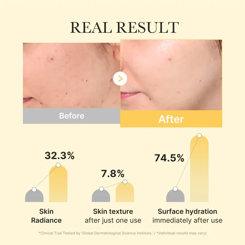 Medicube – Kojic Acid Turmeric Brightening Gel Mask