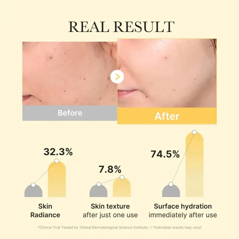 Medicube – Kojic Acid Turmeric Brightening Gel Mask MEDICUBE