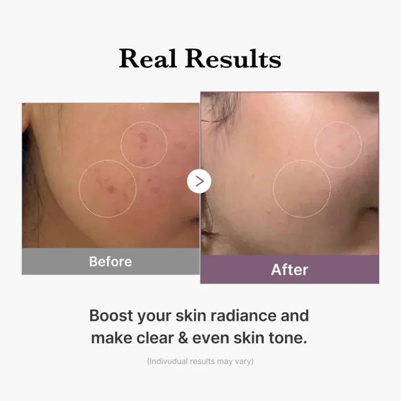 AGE-R Glutathione Glow Toner Medicube