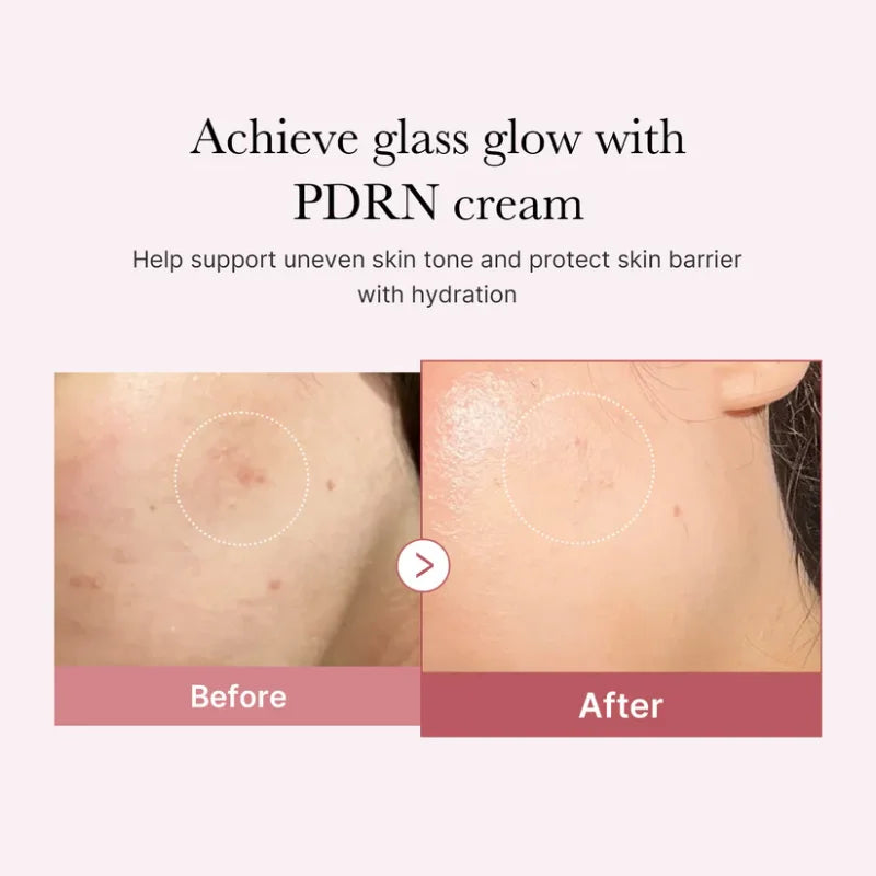 Medicube - PDRN Pink Hyaluronic Moisturizing Cream