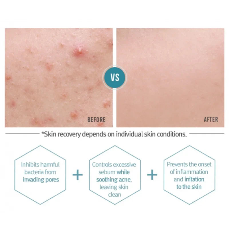 Pyunkang Yul - Acne Cream