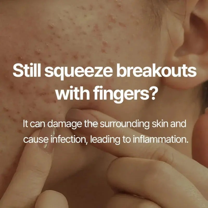 Pyunkang Yul - Pimple Extractor Pyunkang Yul