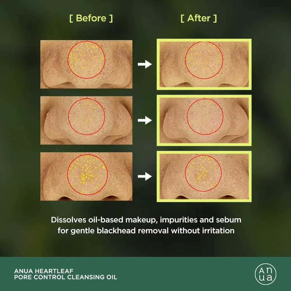 Heartleaf Pore Control Cleansing Oil
