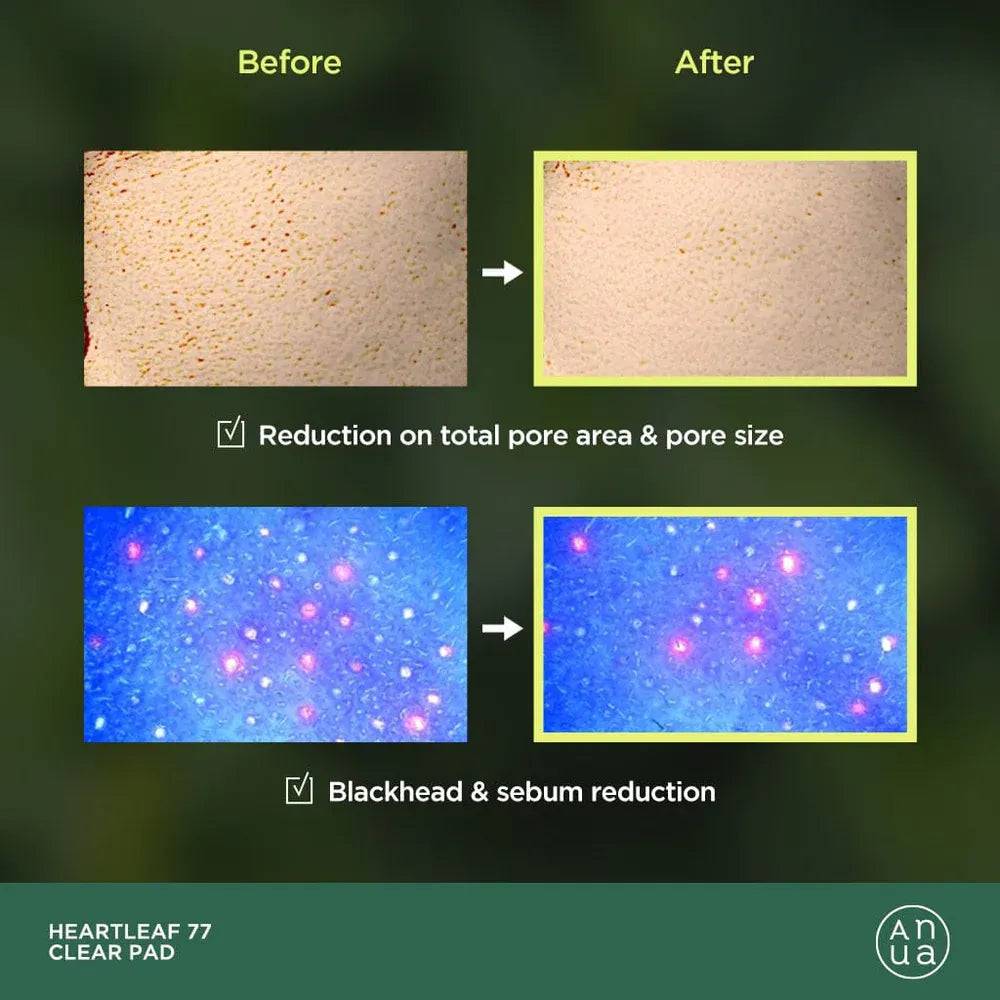 Heartleaf 77% Clear Pad