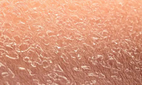 Bedste koreanske hudplejeprodukter til tør hud KLEANSE